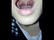 Asian girl uvula