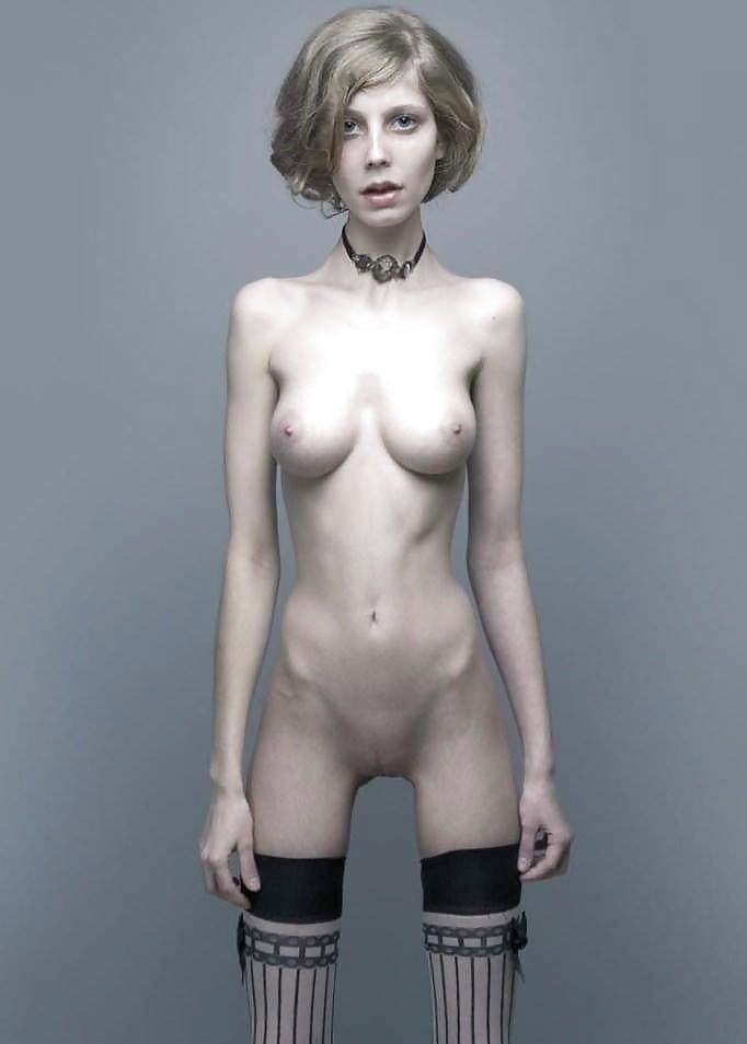 Anorexic Nude Pics