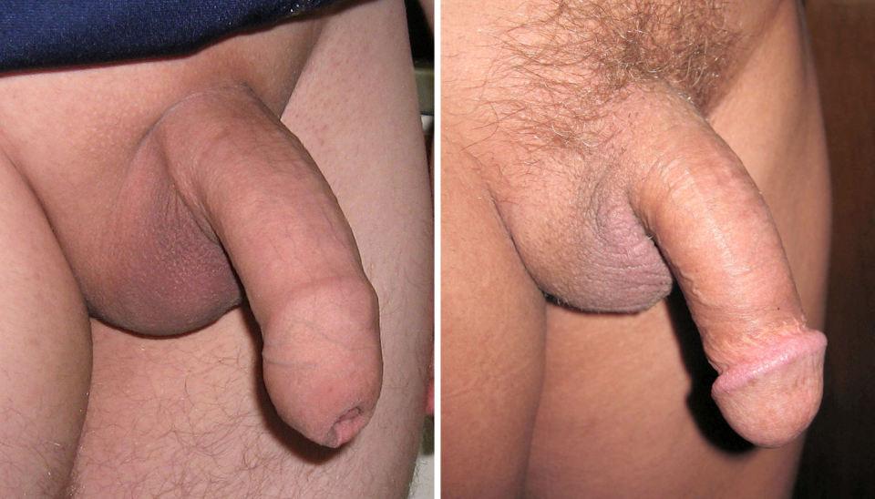 Circumcised dick