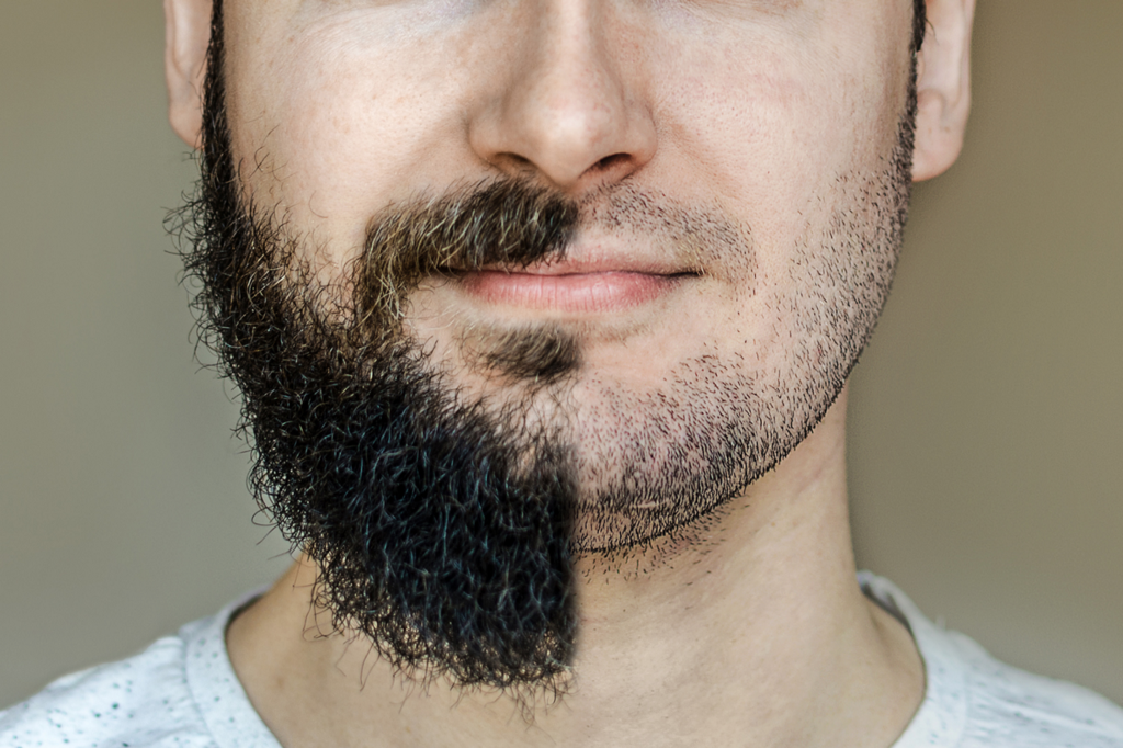 Rover reccomend Asian men with beards